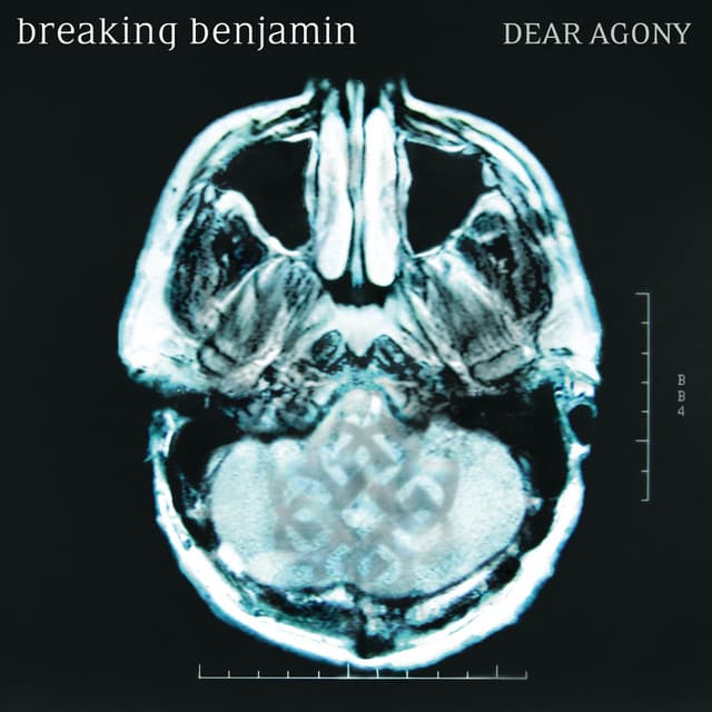 Dear Agony cover art