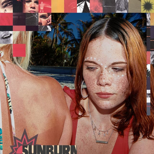 Sunburn cover art