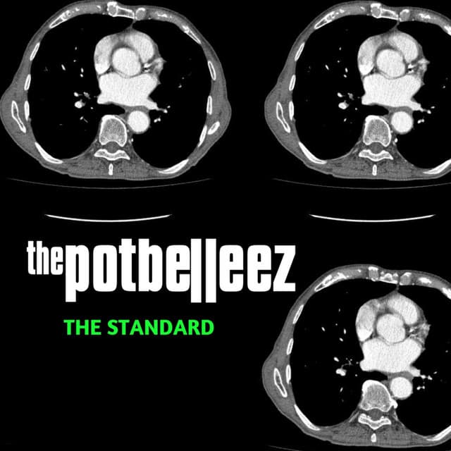 The Standard EP cover art