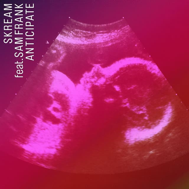 Anticipate (feat. Sam Frank) - Cassius Remix cover art