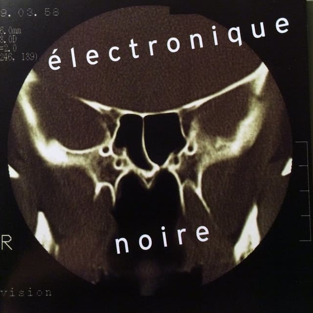 Electronique Noire cover art